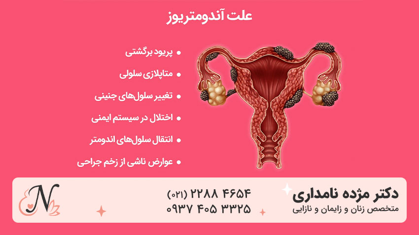ایا اندومتریوز درمان میشود
