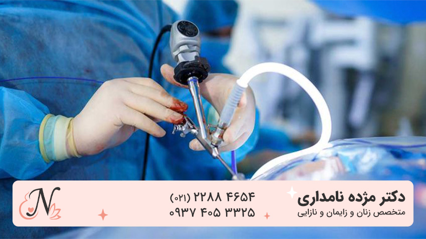 دکتر لاپاراسکوپی در تهران