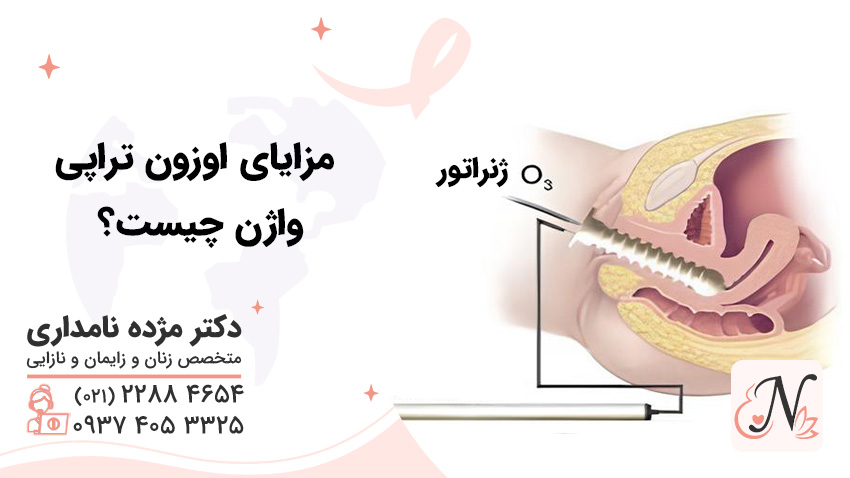 مزایای اوزون تراپی واژن