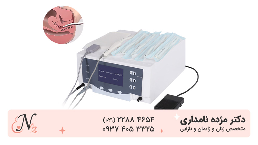 ار اف واژینال برای چیست