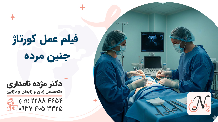 فیلم عمل کورتاژ بقایای جنین مرده با هیستروسکوپی + توضیحات دکتر نامداری