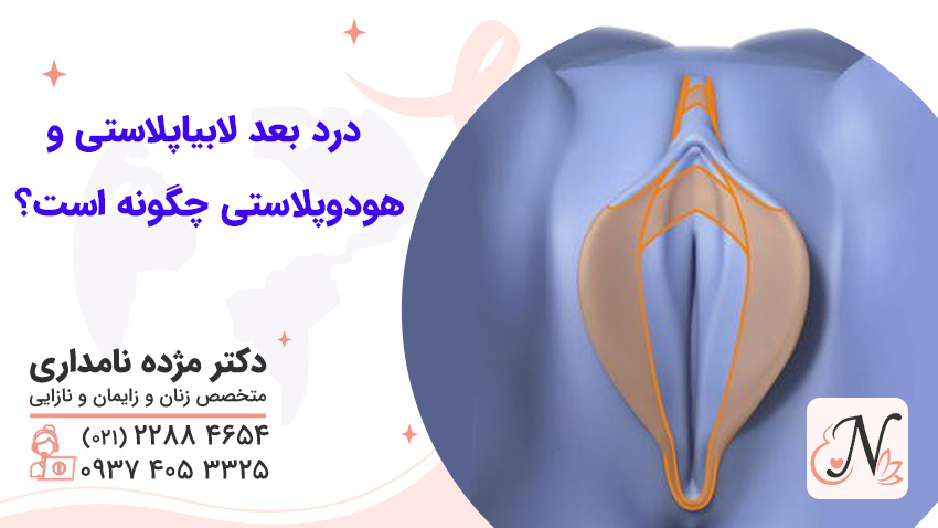 درد بعد لابیاپلاستی