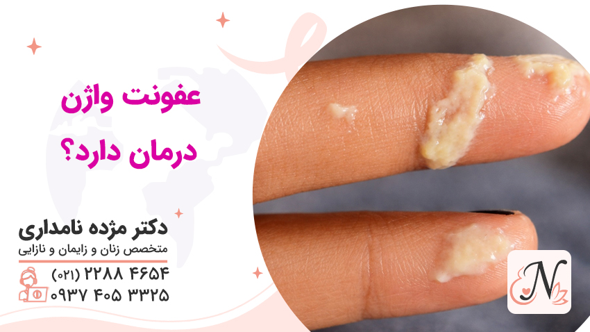 آیا عفونت واژن درمان قطعی دارد؟