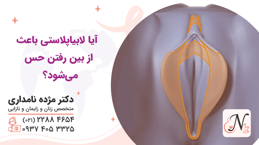 آیا لابیاپلاستی باعث از بین رفتن حس میشود