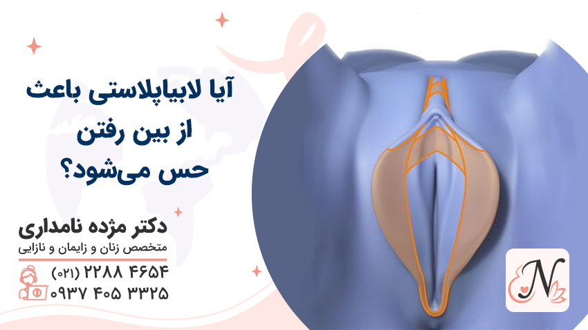 آیا لابیاپلاستی باعث از بین رفتن حس می‌شود؟