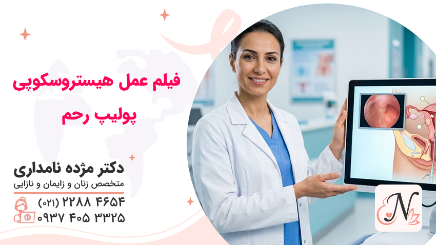 فیلم عمل هیستروسکوپی پولیپ رحم