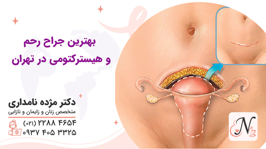 بهترین جراح رحم و هیسترکتومی در تهران